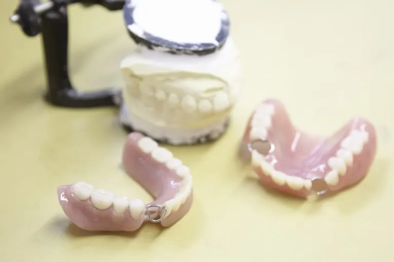 自費の入れ歯